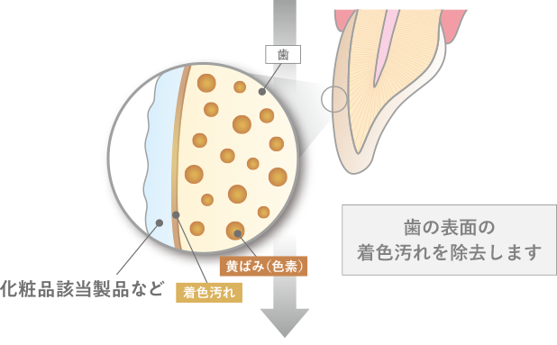 化粧品該当商品など、歯の表面の着色汚れを除去します